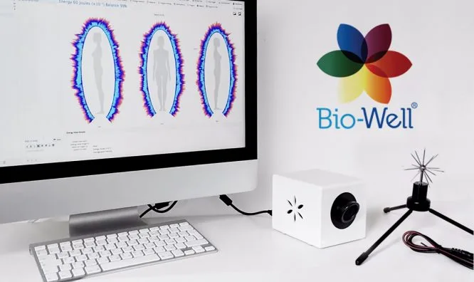 bio-well GDV kamera in prikaz posnetkov na zaslonu
